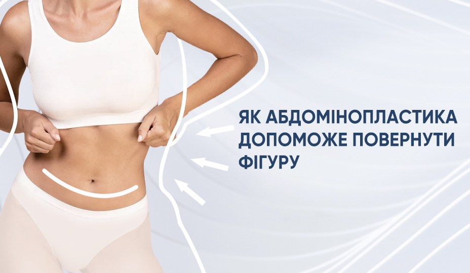 abdominoplasty